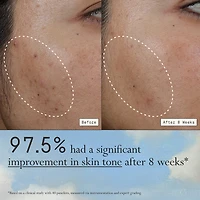 Deliverance Antioxidant & Niacinamide Serum For Calm & Even Skin