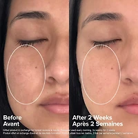 Soin de niacinamide à 20 % CLINICAL