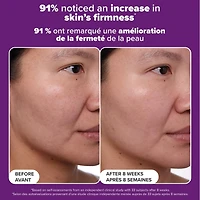 Soin clinique antiâge au rétinol à 1 %