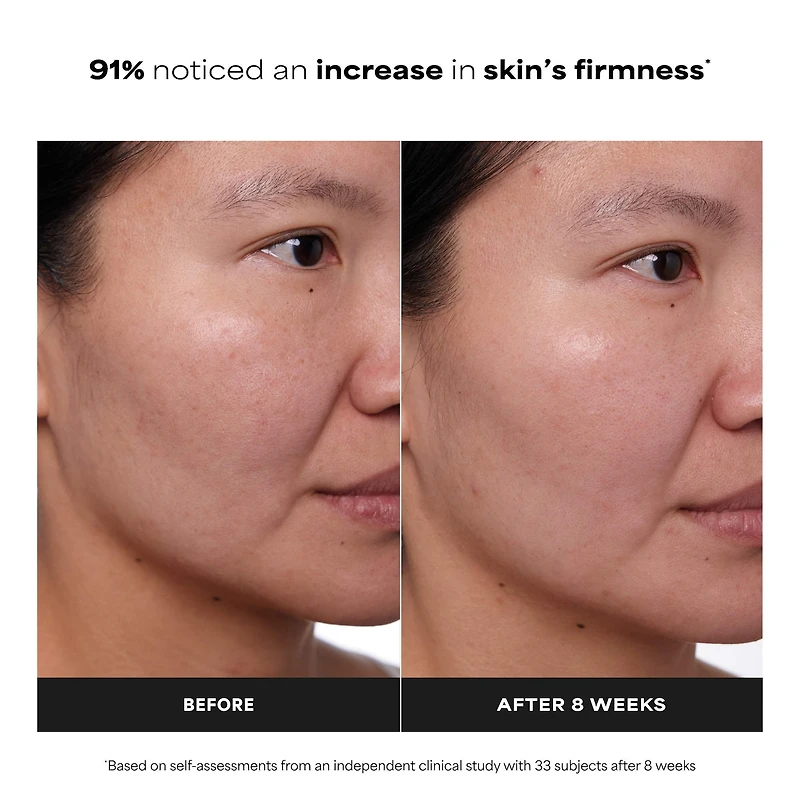 Soin clinique antiâge au rétinol à 1 %