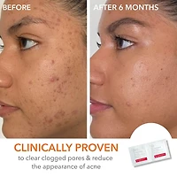 Smooth, Radiant, Firm Kit for Normal / Oily Skin
