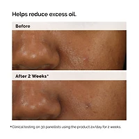 Balancing & Clarifying Serum for Oily Skin and Pore Refinement