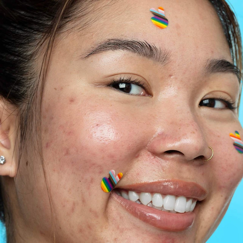 Salicylic Acid Acne Healing Dots