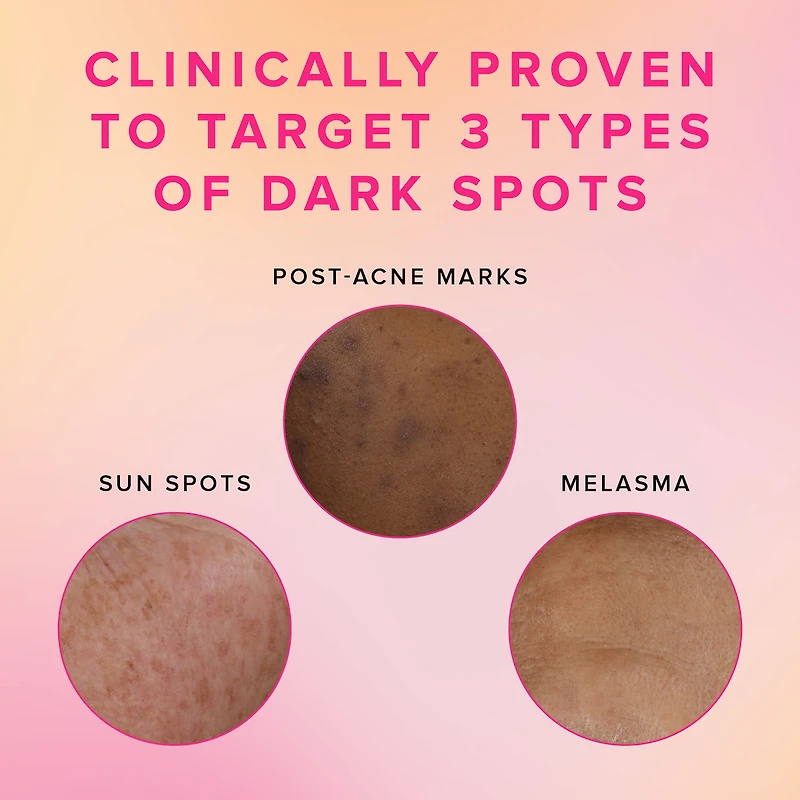 Brighten Up 3% TXA Dark Spot Toner with Azelaic Acid