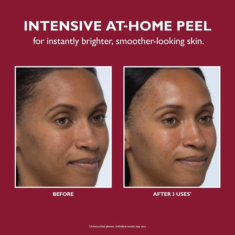 Even Smoother™ Instant Reveal Facial Peel