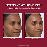 Even Smoother™ Instant Reveal Facial Peel