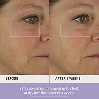 The Dewy Skin Cream Hydrating & Firming Refillable Moisturizer