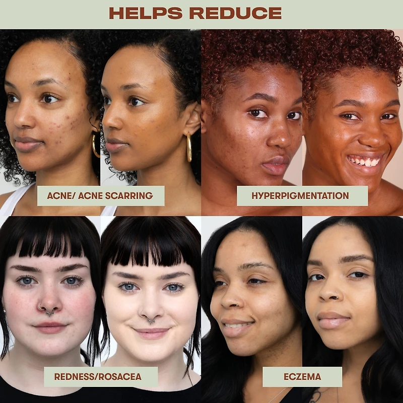 True Intentions Skin-Soothing Hydrating Foundation
