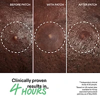 Hydrocolloid Invisible Pimple Patches + Salicylic Acid