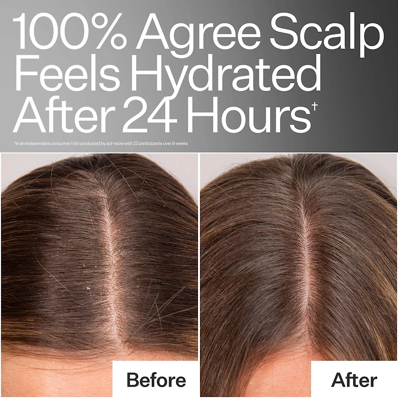 Daily Hydro™ Scalp Serum with Hyaluronic Acid for Dry Scalp