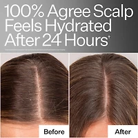 Daily Hydro™ Scalp Serum with Hyaluronic Acid for Dry Scalp
