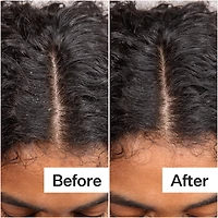 Daily Hydro™ Scalp Serum with Hyaluronic Acid for Dry Scalp
