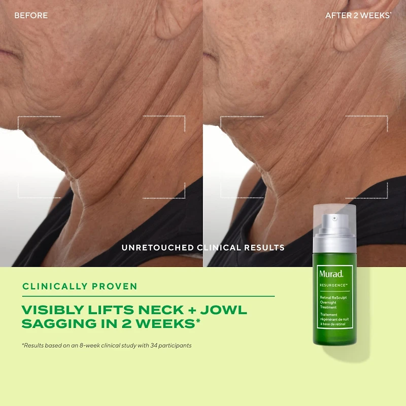 The Science of Healthy Skin: Lift and ReSculpt with Retinal