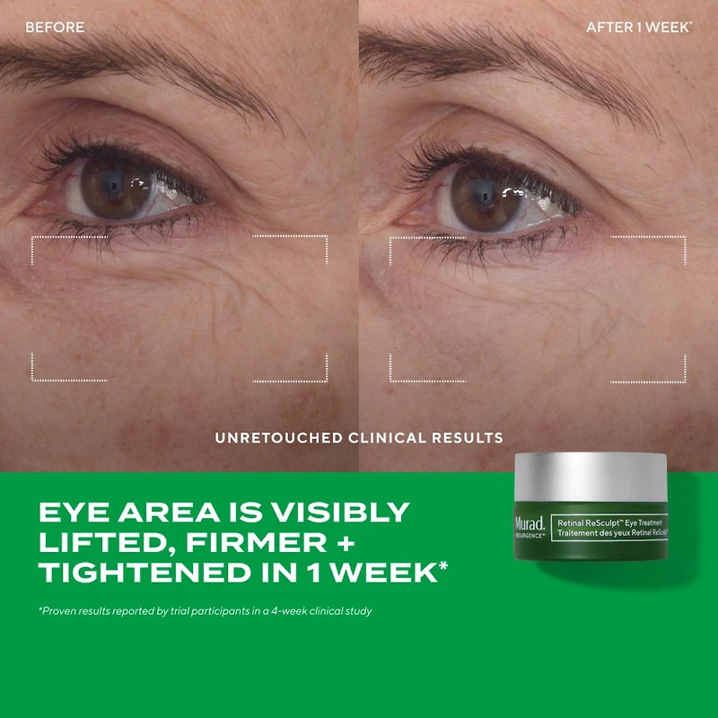 The Science of Healthy Skin: Lift and ReSculpt with Retinal