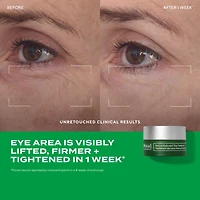 The Science of Healthy Skin: Lift and ReSculpt with Retinal