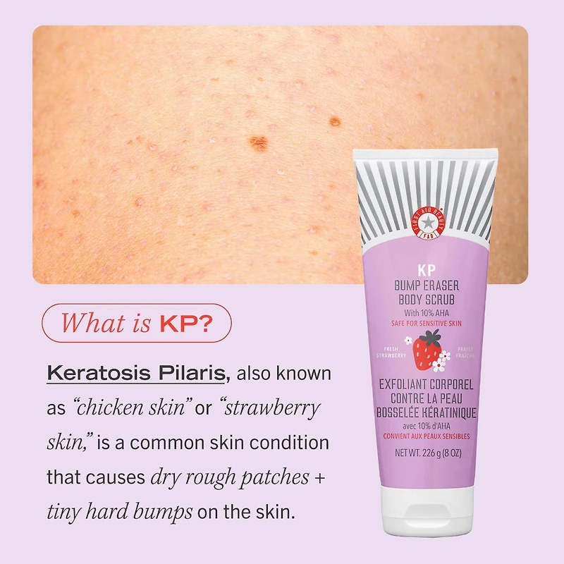 Exfoliant pour le corps KP Bump Eraser avec 10 % d’AHA cibler la kératose pilaire
