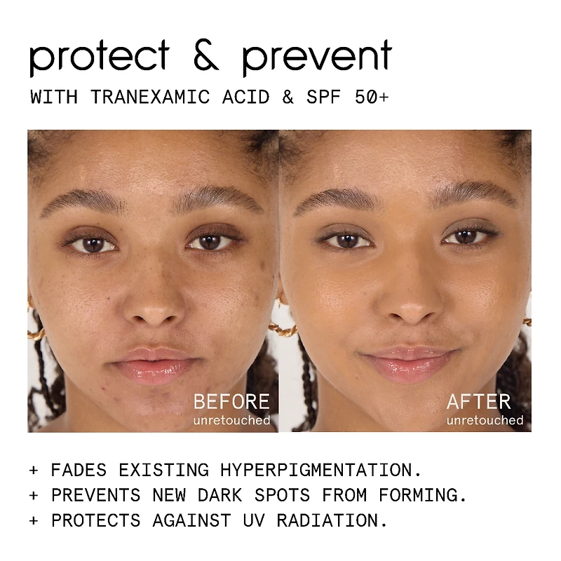 conceal & PROTECT SPF 50+ spot concealer for dark spots
