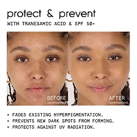 conceal & PROTECT SPF 50+ spot concealer for dark spots