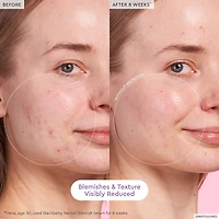 Blackberry Retinol Blemish Serum