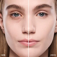 Anticernes SurrealSkin™ Awakening