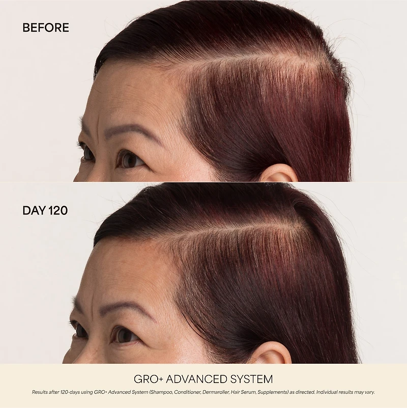 Sérum GRO+ Advanced pour cheveux très clairsemés
