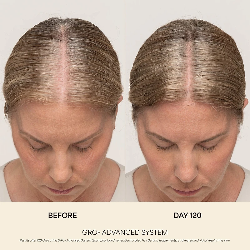 GRO+ Advanced Hair Serum for Severe Signs of Thinning