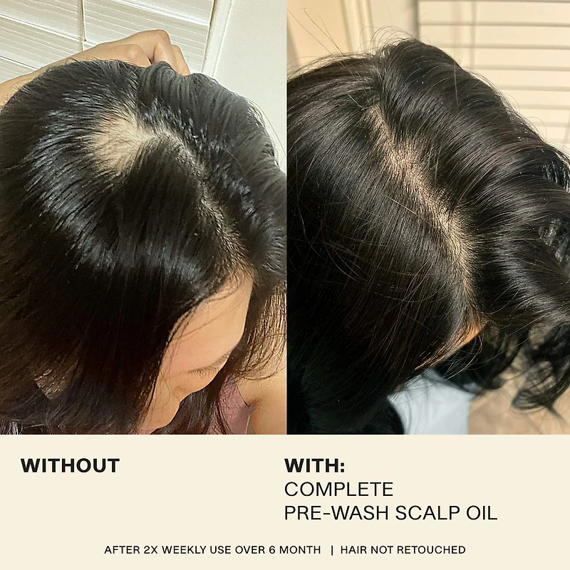Huile de prélavage complète pour le cuir chevelu et le renforcement des cheveux