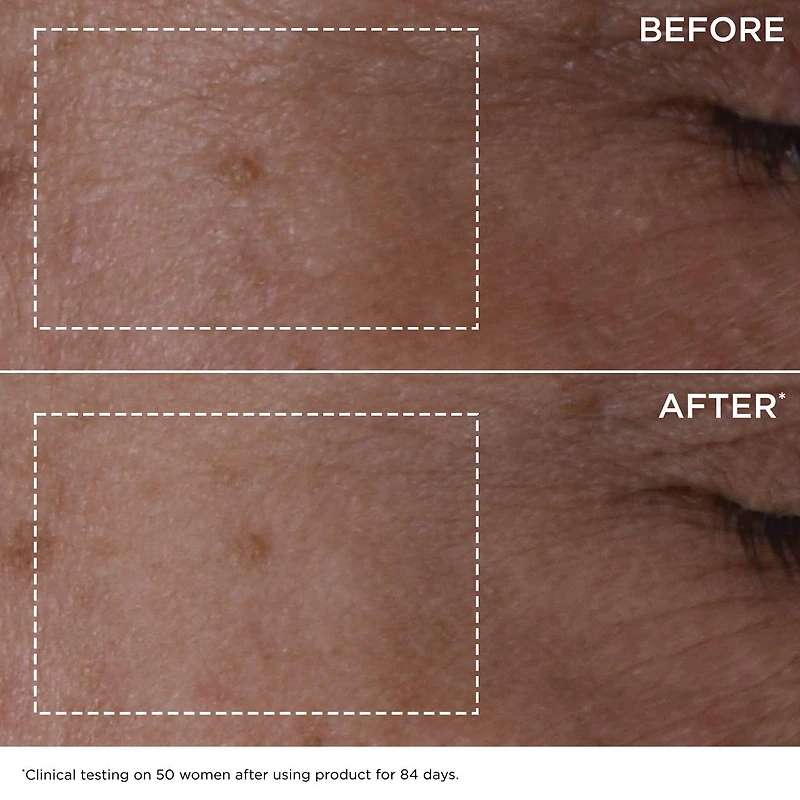 Double Serum Anti-âge raffermissant, améliorant l’éclat et affinant les pores