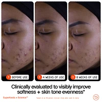 Superfruit Gentle Exfoliating Cleanser with Vitamin C + Papaya