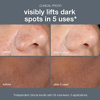 PowerBright Dark Spot Peel