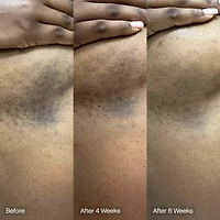 Faded Brightening & Cleansing Body Bar for Uneven Skin Tone (2 Pack)