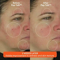 Pep Talk Barrier Repair Cream with Peptides + Ceramides + Triple Lipid Complex