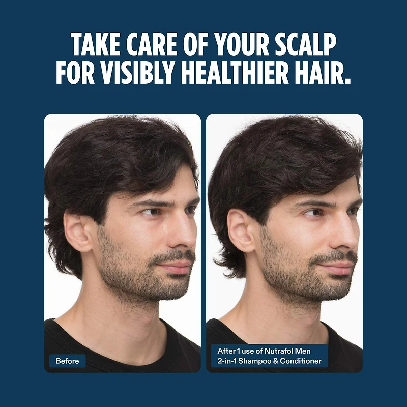 Men's Active Cleanse Scalp Shampoo + Conditioner for Thinning Hair