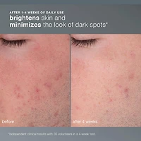 Exfoliant rechargeable Daily Microfoliant