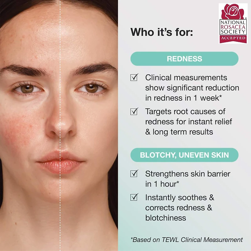 Calm the Red Down Dual Chamber Redness Treatment Serum