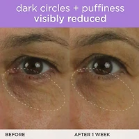 The Brightening Eye Cream with Vitamin-C for Dark Circles