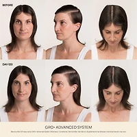Sérum GRO+ Advanced pour cheveux très clairsemés
