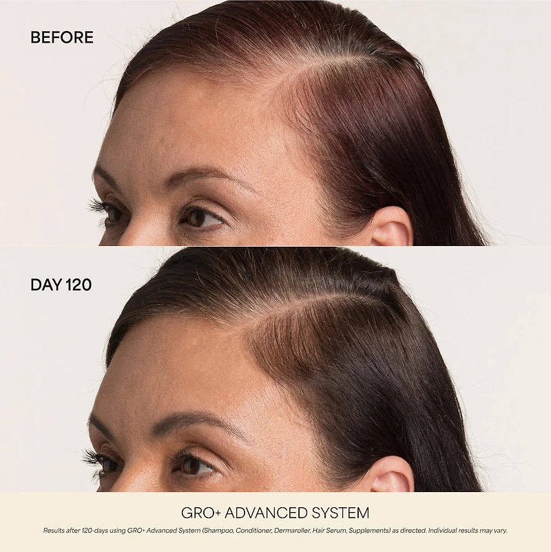 Sérum GRO+ Advanced pour cheveux très clairsemés