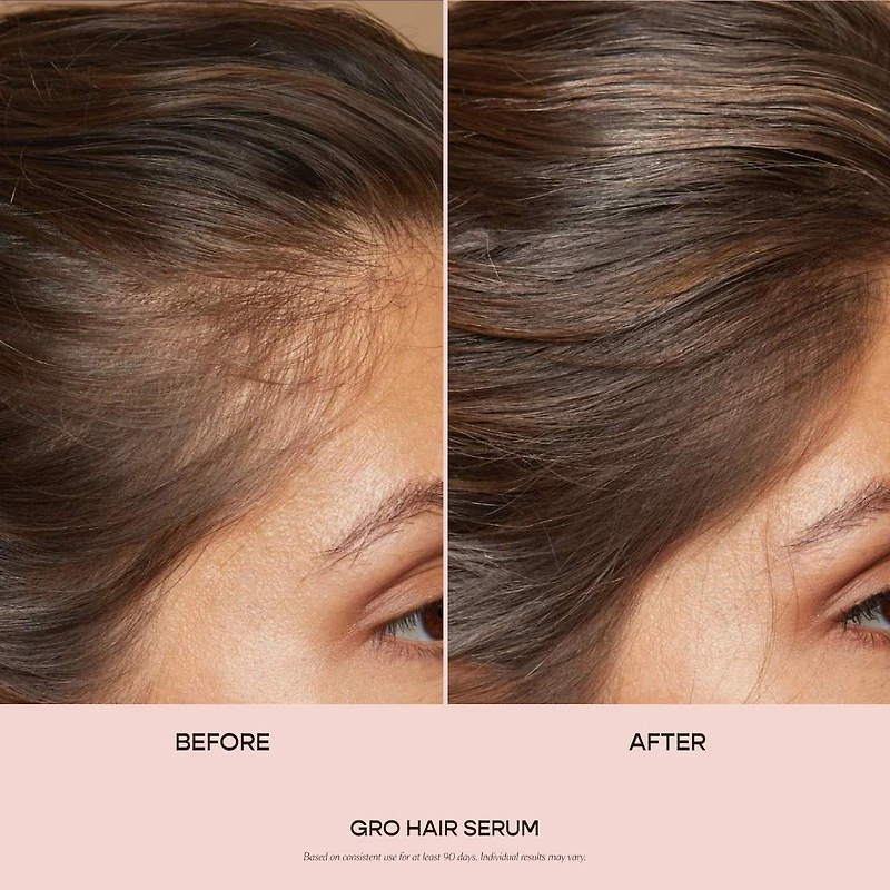 Sérum pour les cheveux GRO clairsemés