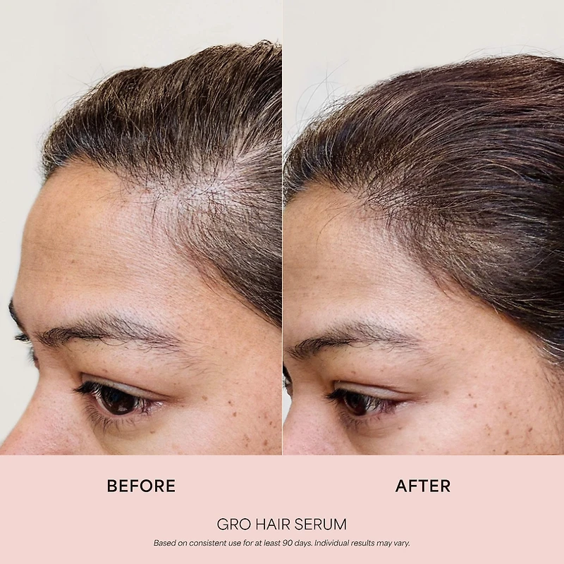 GRO Hair Serum for Thinning