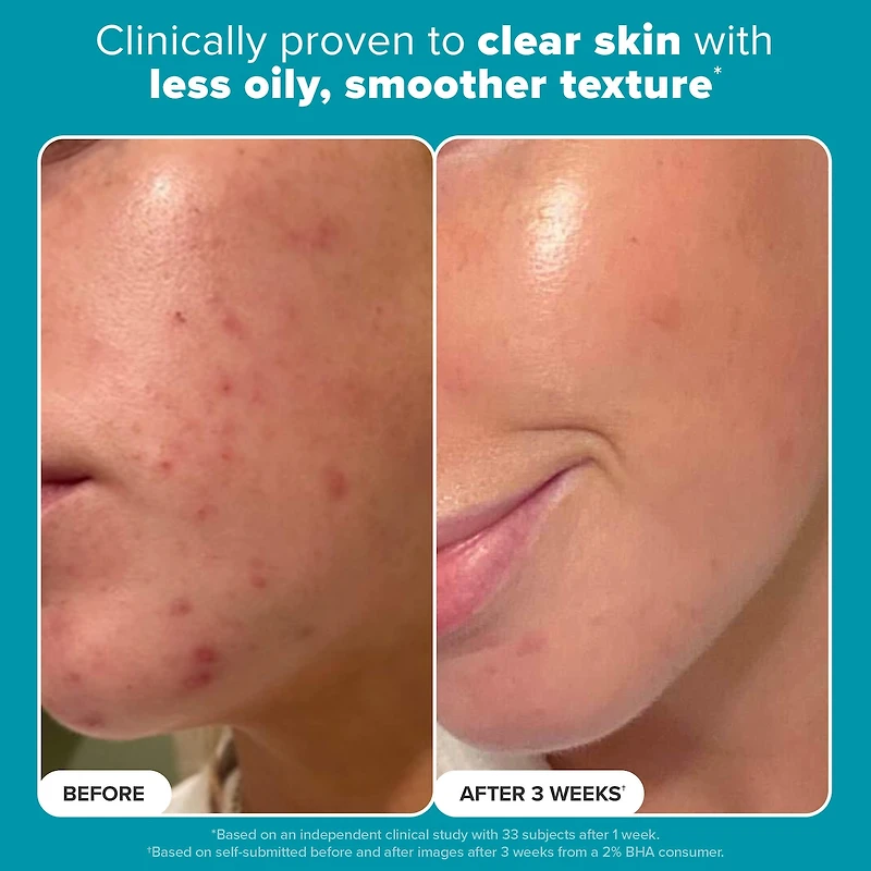 Lotion tonique exfoliante Skin Perfecting 2 % BHA pour une peau nette