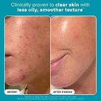 Lotion tonique exfoliante Skin Perfecting 2 % BHA pour une peau nette