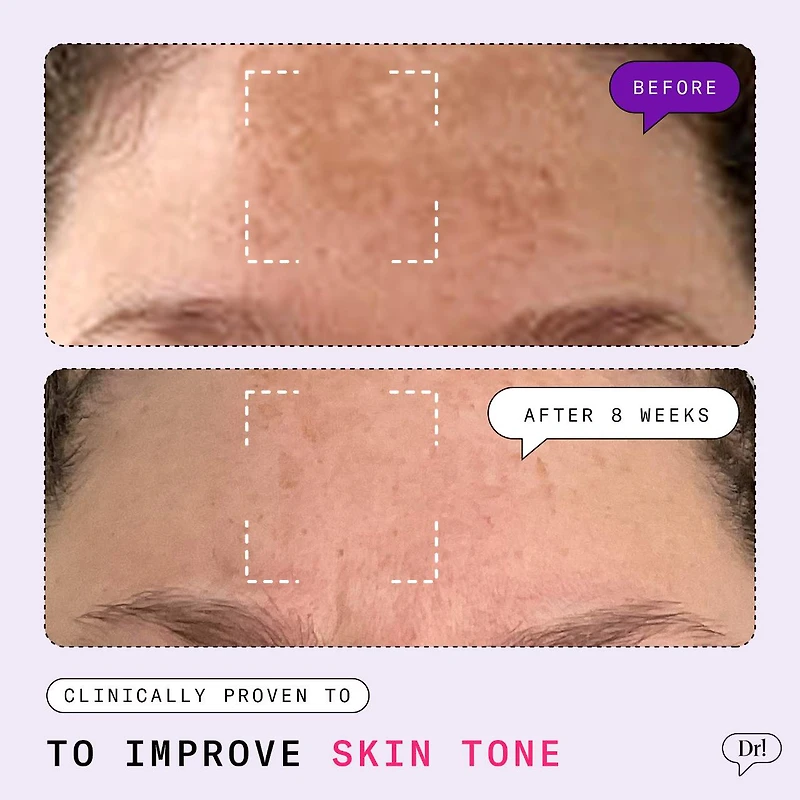 Major Fade Hyper Serum Dark Spot Treatment