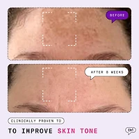 Major Fade Hyper Serum Dark Spot Treatment
