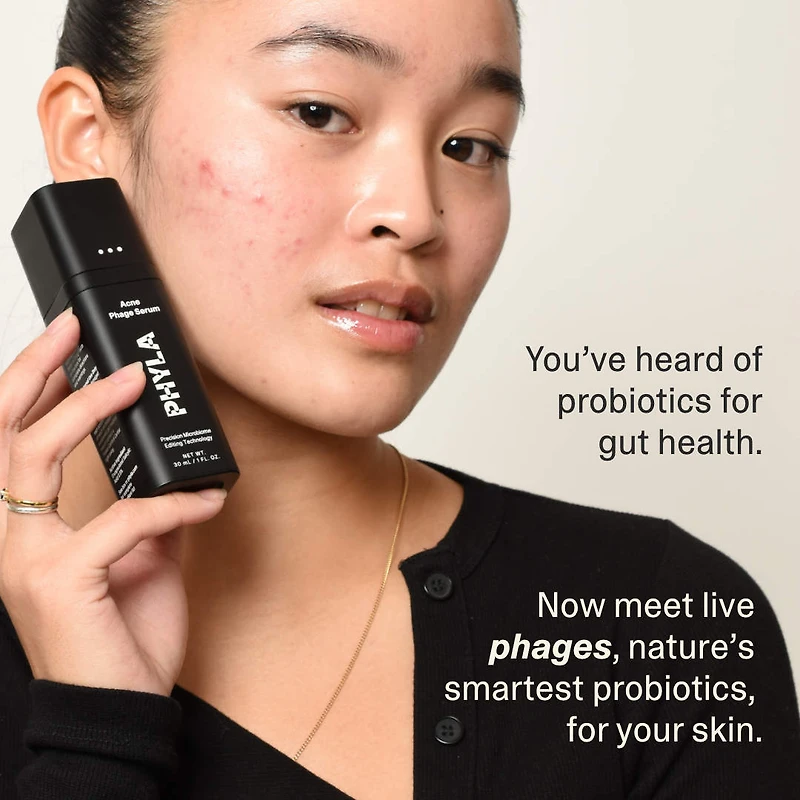 Acne Phage System