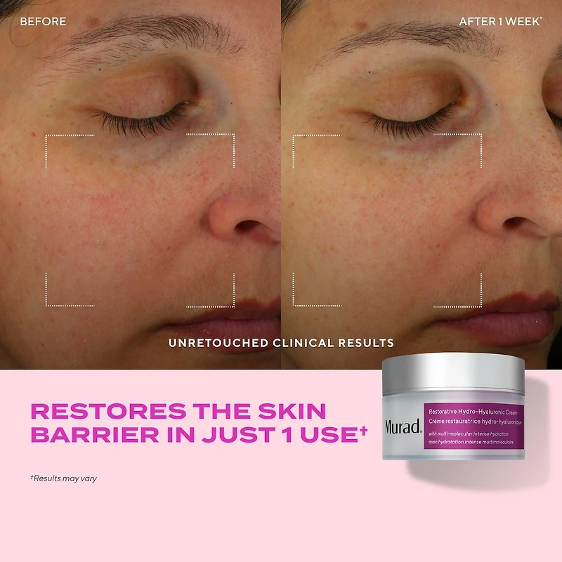 Crème hydratante hydro-hyaluronique réparatrice