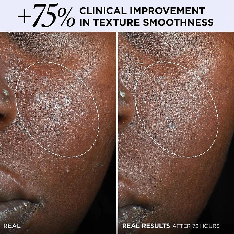 Crème hydratante quotidienne pour le renforcement et réparation de la barrière cutanée Confidence in a Cream®