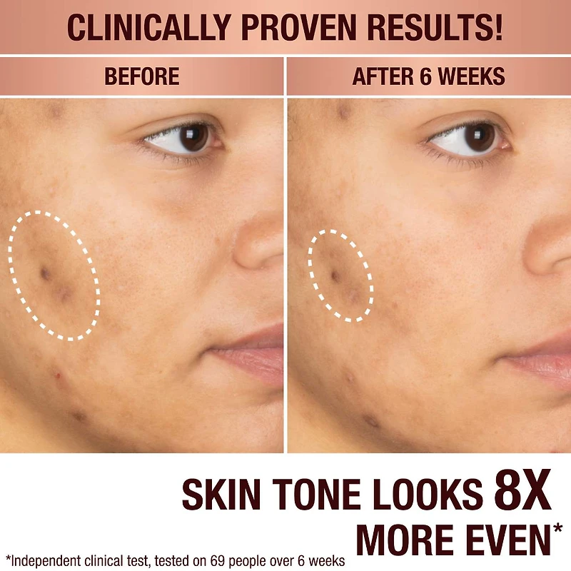 Dark Spot Correcting Radiance Recovery Serum