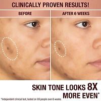 Dark Spot Correcting Radiance Recovery Serum