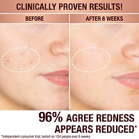 Dark Spot Correcting Radiance Recovery Serum